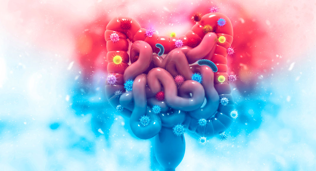 Cáncer de colon