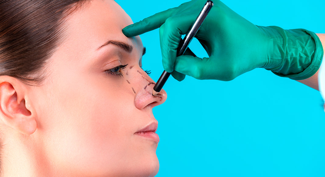 Rinoplastia, mejora estética y funcional de la nariz
