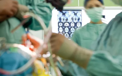 Avances en cirugía de cáncer de cabeza y cuello Avances en cirugía de cáncer de cabeza y cuello