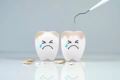 Colores de las manchas en los dientes: qué indican Manchas en los dientes; colores