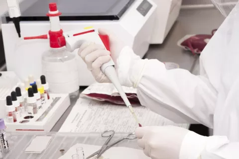 Resultados de un análisis bioquímico Resultados de un análisis bioquímico en el laboratorio