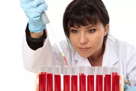 Tipos de anemias Clasificación de las anemias